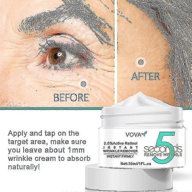 Retinol Wrinkle Removal Face Cream Firming Lift Anti-aging Eye Fade Fine Lines B