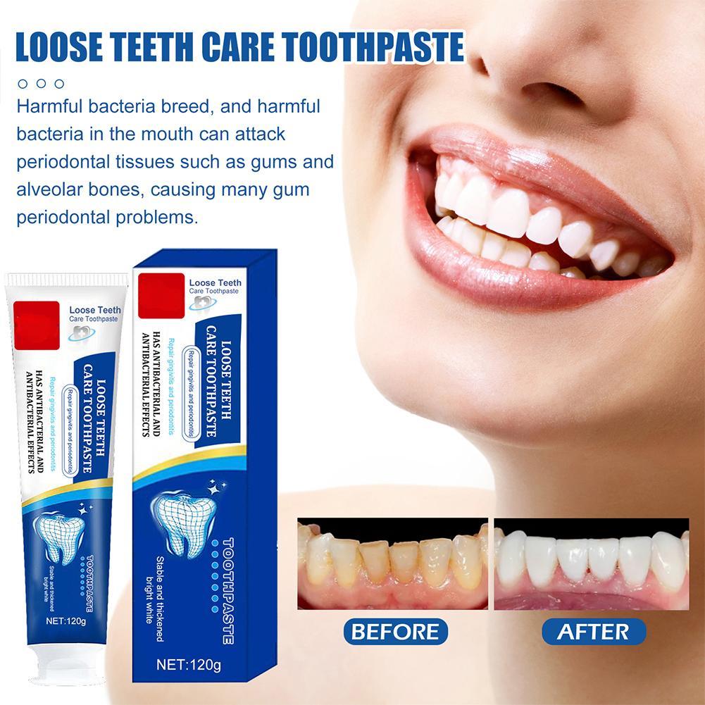 Быстрое восстановление кариеса, отбеливание зубов, зубная паста, удаление налета, пятен, распад, свежее дыхание, восстановление, средство для ухода за зубами, 100 г