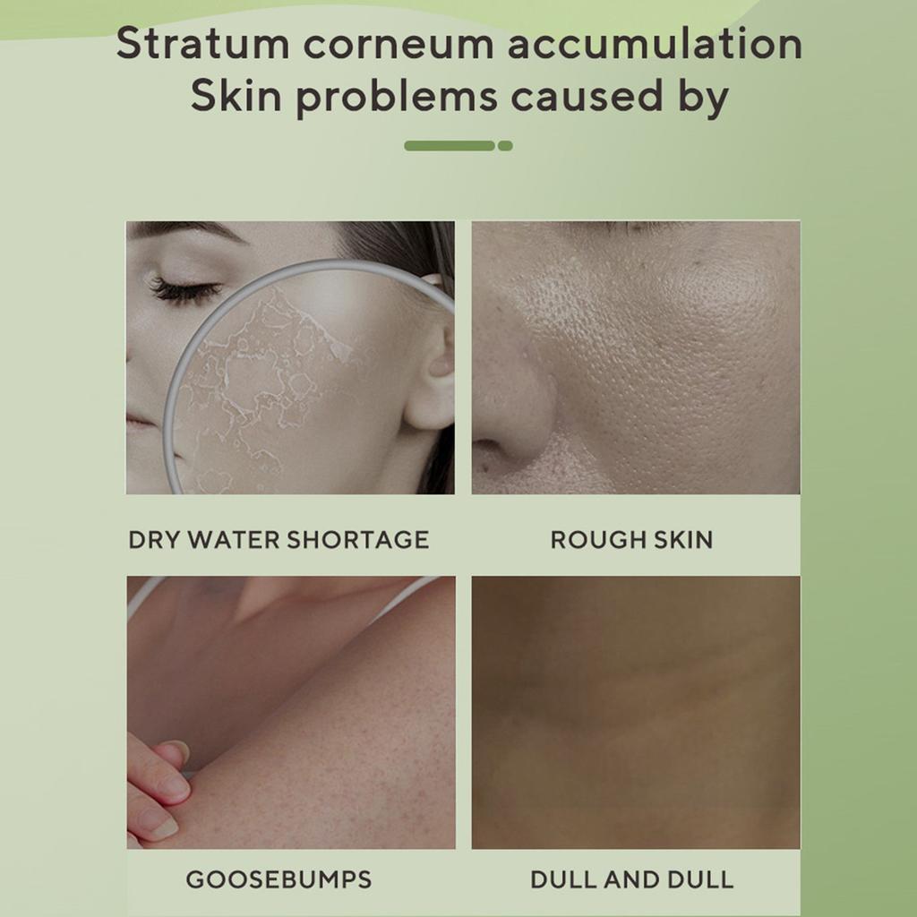 Urea Cream 40%, Hand & Foot Moisturizer For Dry Cracks Nourishes The Hands And Feet And The Skin Is Smooth And Soft,150g