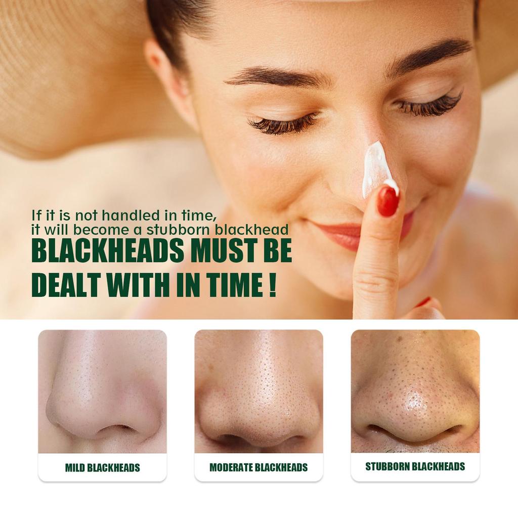 EELHOE Blackhead Removal Nose Strips: Deeply Cleanses Pores, Gently Removes Blackheads and Whiteheads, Oil-controlling Mud Mask.