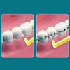 10Pcs Orthodontic Interdental Brushes Steel Wire Push-Pull Toothbrush for Oral Hygiene Food Remover Whitening Cleaner