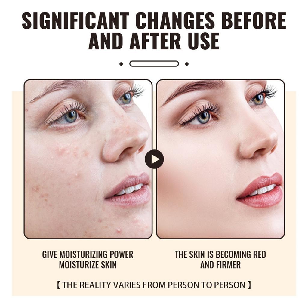 Крем с медом и говяжьим жиром 120 г Увлажняющий крем для лица Увлажняющий и увлажняющий крем для смягчения кожи