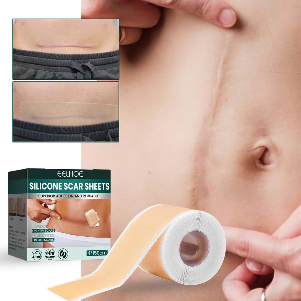 EELHOE 1 Roll Silicone Scar Removal Sheets for C-Section Postoperative Skin Colored Invisible Beauty Tape