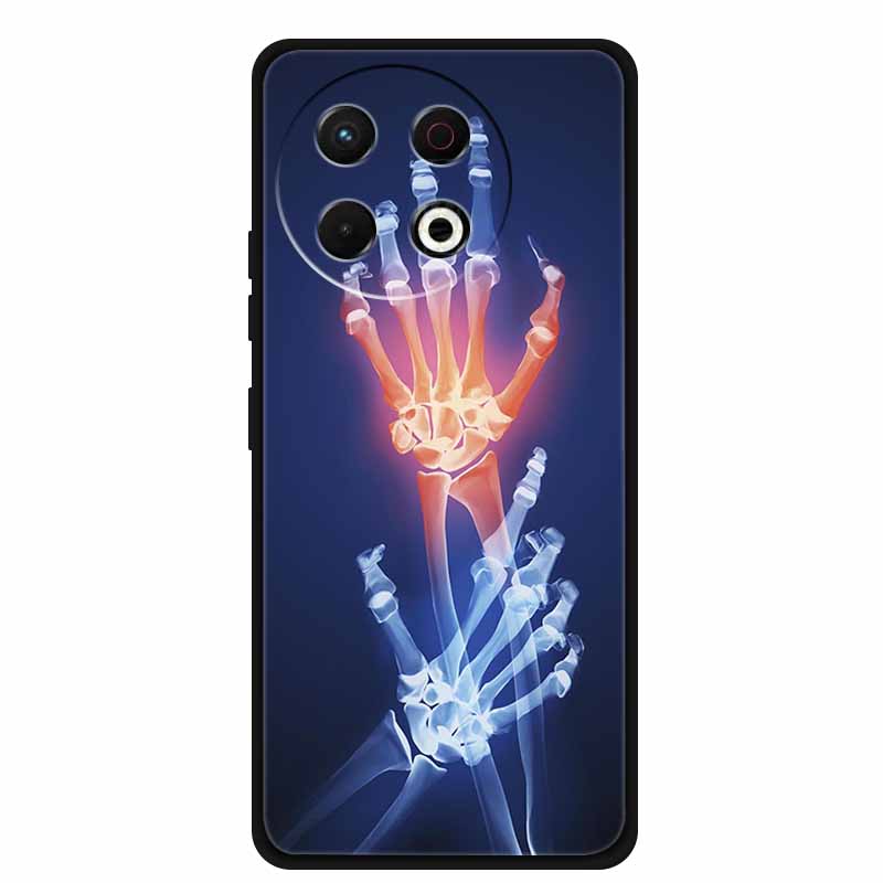 Чехол для телефона Tecno Spark 30 Pro 4G Задняя крышка 6.78" Черный Силиконовый Мягкий Чехол для Tecno Spark 30 Pro Чехол Spark30 Pro Сумка