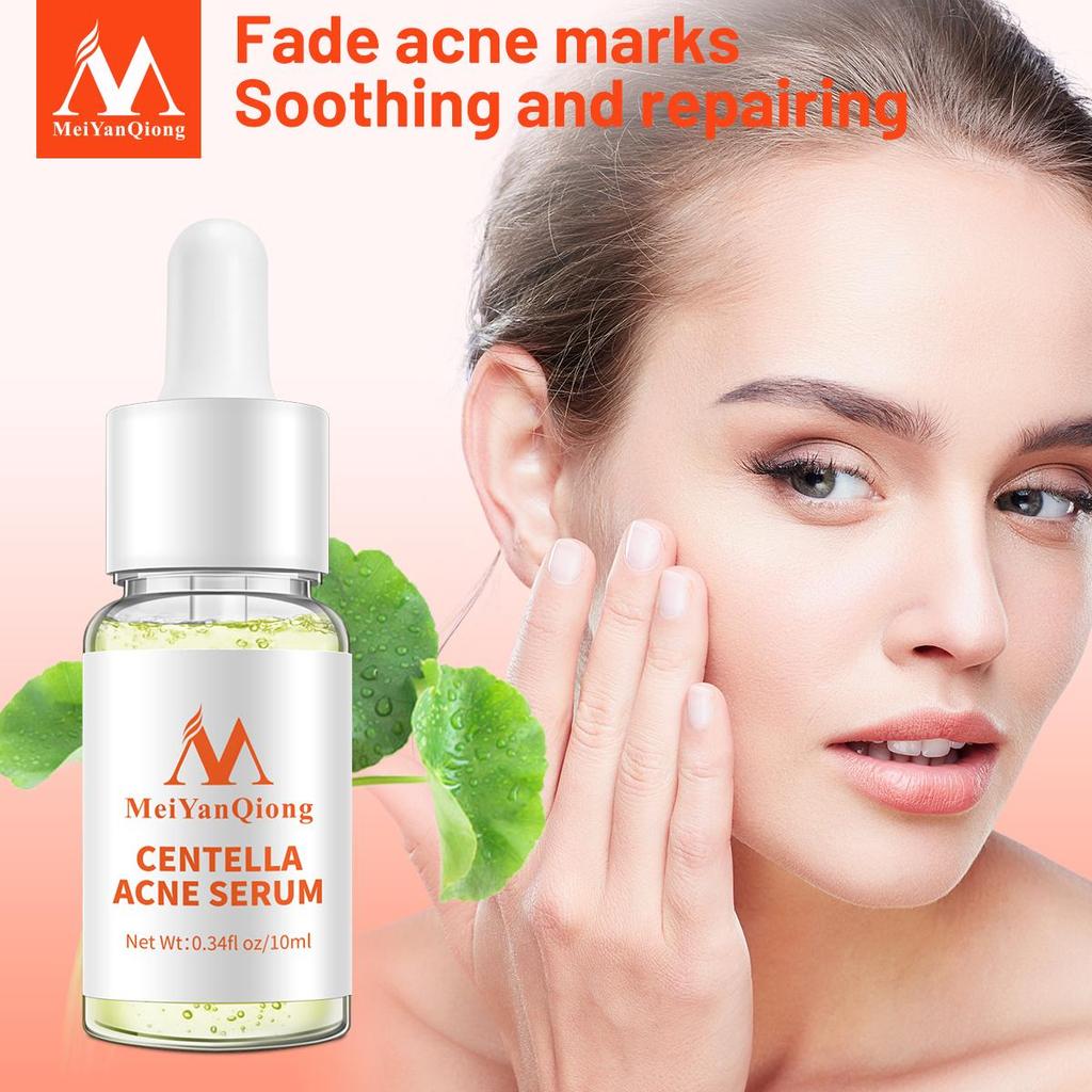 Сыворотка на травах против акне, предотвращает появление морщин. Уменьшает поры. Контролирует жирность кожи лица