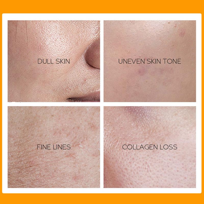 FENYI Крем-сыворотка с витамином С, 40 г, увлажняющий крем, средства по уходу за кожей