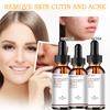 Retinol Instant Wrinkle Remove Face Serum Lifting Firming Antiaging Fade Fine Lines Whitening Korean Care Cosmetic Beauty Health