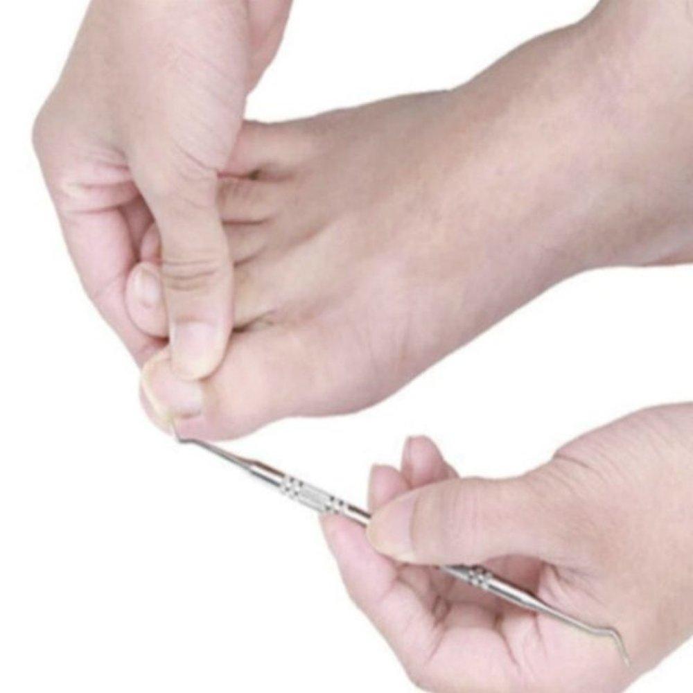 Cuticle Nail Removal Self (WF58322)