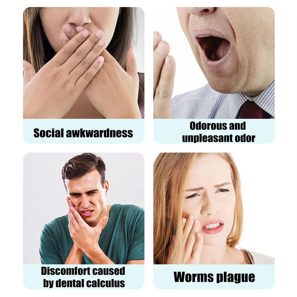 Спрей для растворения зубного камня Fresh Mouth Care Портативный спрей для полости рта 20 мл