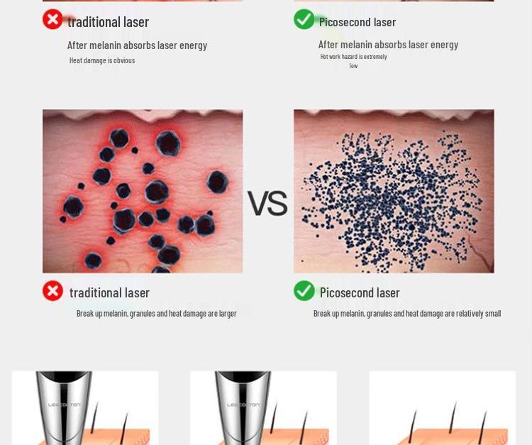 Портативная пикосекундная лазерная ручка для удаления татуировок, веснушек и бровей с красным и синим светом