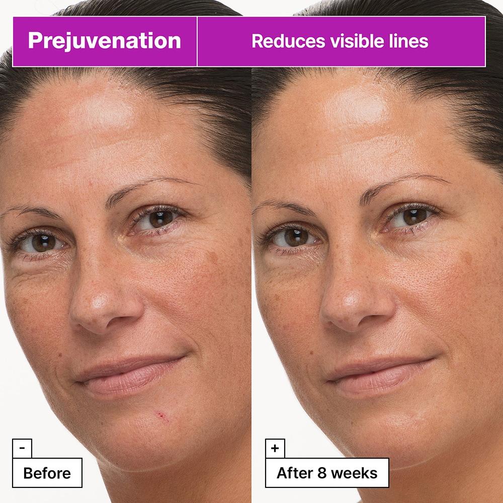 Dr.Jart+ Prejuvenation Firming Bakuchiol Cream 50 мл