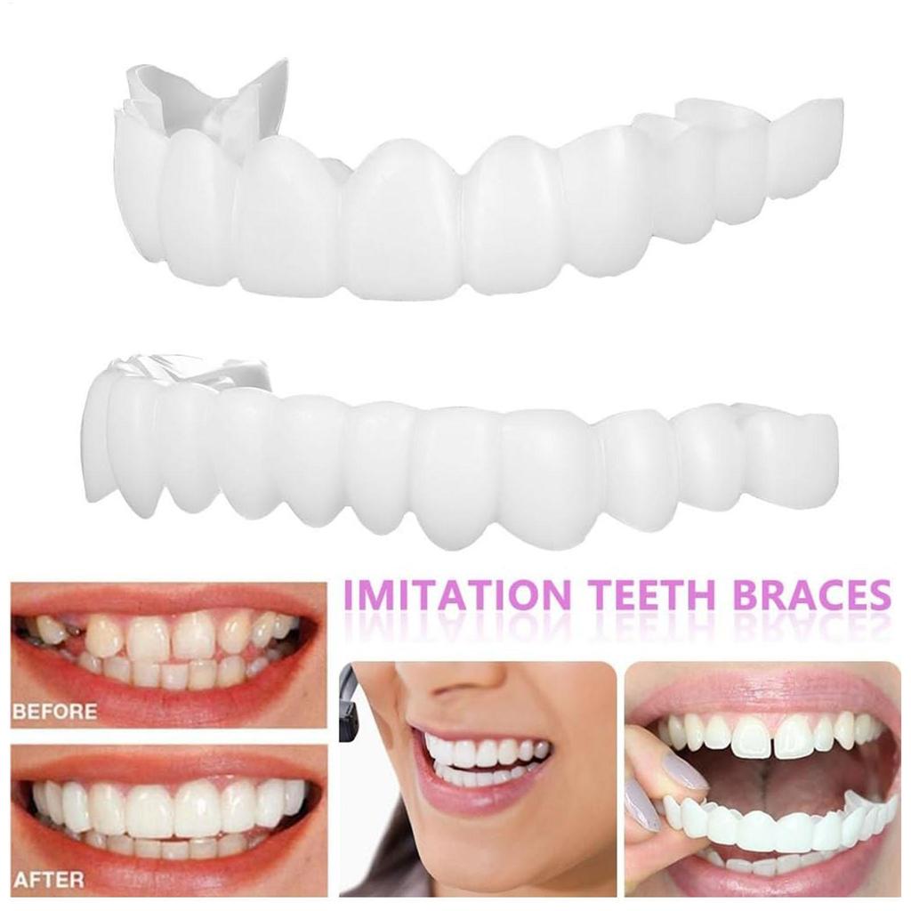 1 Pair Teeth Veneers Men Women Brightening Dentures Temporary False Teeth Cover Instant Imitation Braces For Confidence Smile