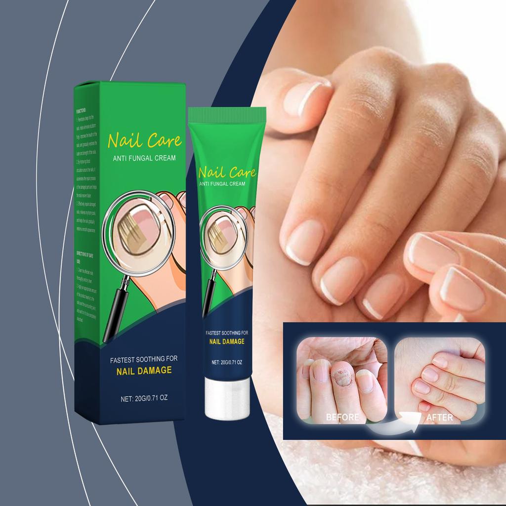 Крем для лечения онихомикоза Bright Nails Thick Nails Уход за пальцами ног Onychomycosis Soothing Nail Care Cream