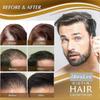 1-3x Biotin Hair Growth Spray Anti Hair Loss Fast Regrowth Scalp Treatment Serum 20ml for Men & Women