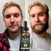 100% Original Beard&hair Growth Liquid Beard Growth Oil Fluid Natural Vitamin E Nutrition