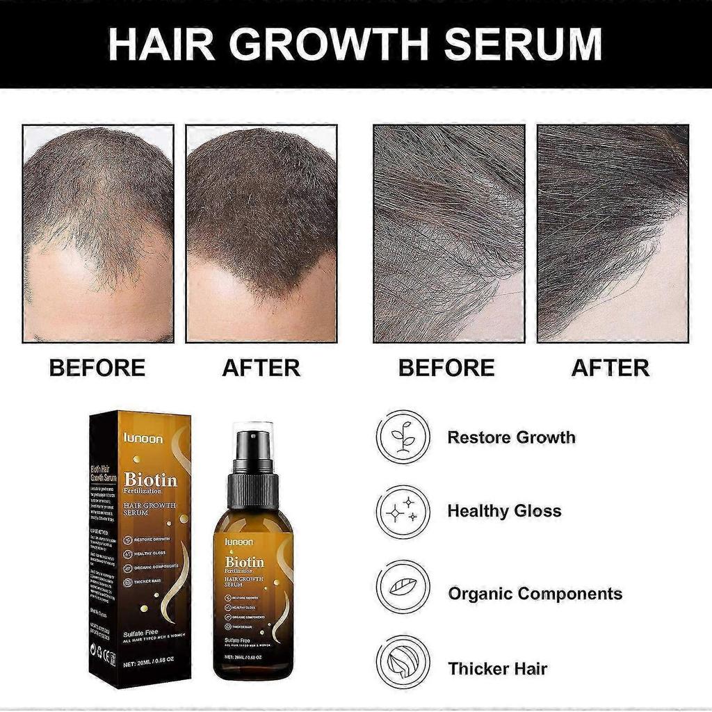Biotin Hair Growth Serum Spray, Biotin Hair Regrowth Topical Solution Anti Hair Loss Treatment Hair
