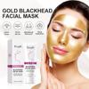 Cleansing Anti-Blackhead Facial Peeling Mask 40g