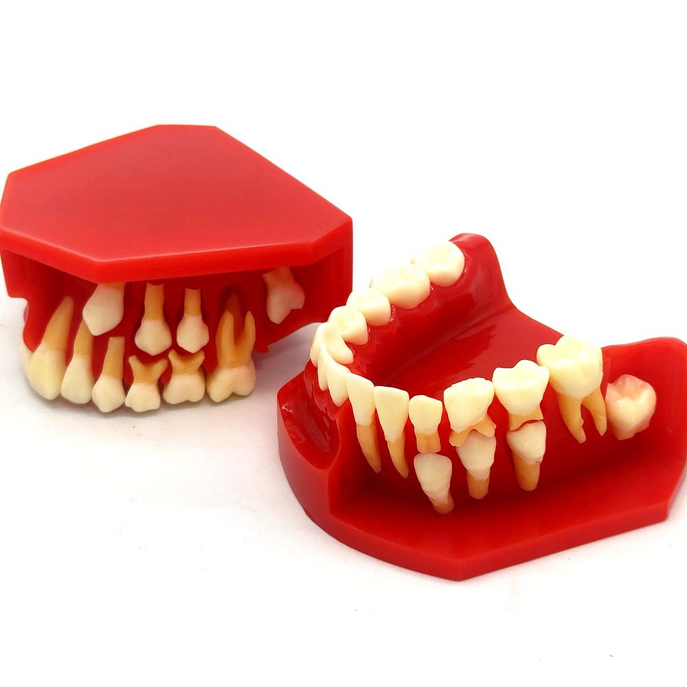 Стоматологическая детская модель молочных зубов Сменная модель Постоянные зубы Альтернативный дисплей Съемная демонстрация для обучающих моделей стоматологов