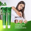Herbal Cream Mosquito Bites and Itchy Skin Anti-itch Topical Cream