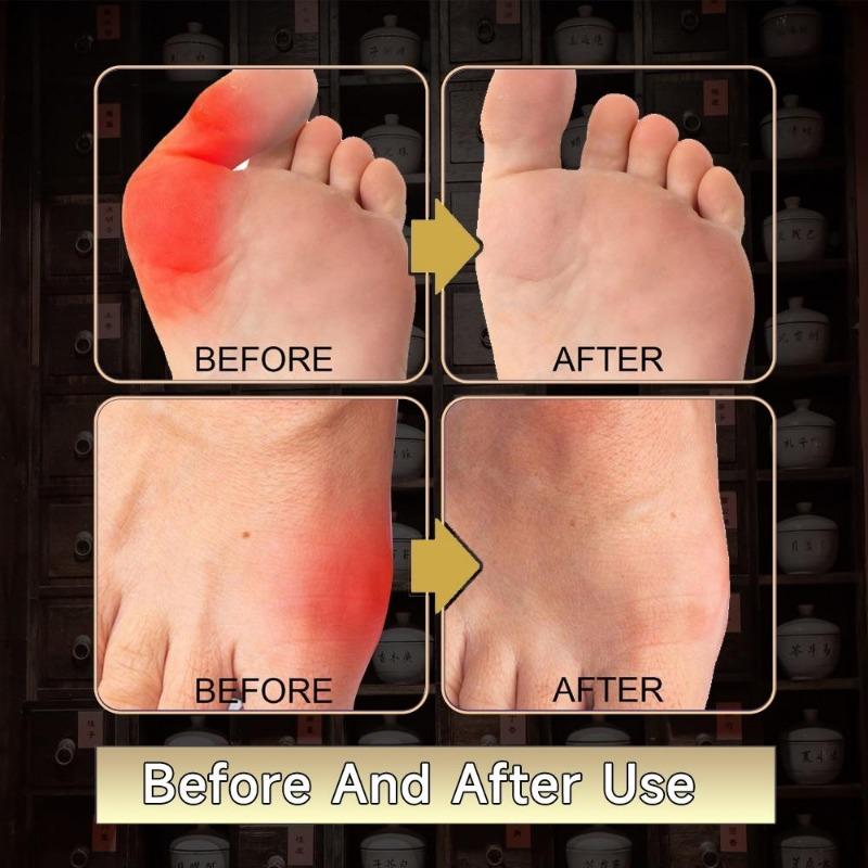 1/10/30/50 шт./пакет Натуральные травы для снятия боли на пальцах ногах пластырь для лечения подагры пластырь на большой палец наклейка для суставов костей