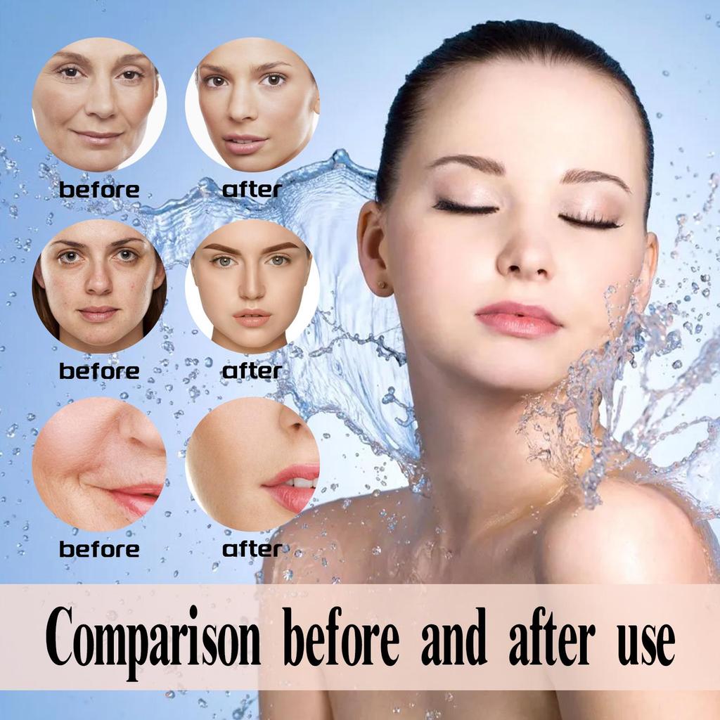 Hoygi Retinol Essence Lotion – Minimizes fine lines, hydrates, nourishes, reduces wrinkles, and tightens facial skin to combat aging