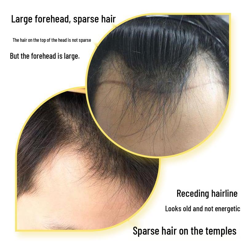 Unisex Hairline Toupee Stickers: Full Hair Toupee, Sideburns Replacement, Forehead Coverage, M-Shaped Hairline Coverage.