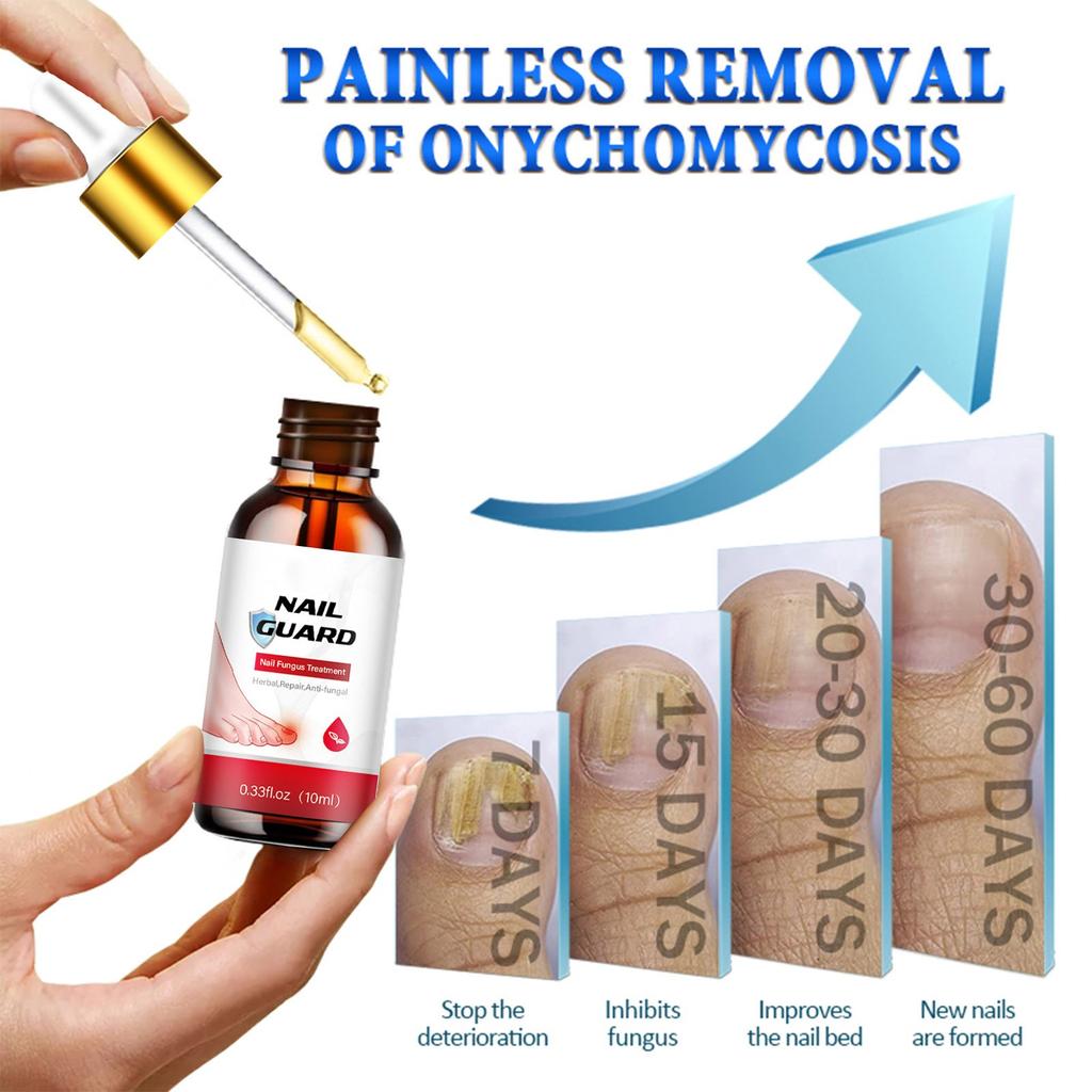 Toenail Fungal Super Strong Nail Care Nail Care Super Strong For Thick Discolored And Damaged Nails10ml