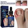 Cure Ingrown Toenail Treatment Infection Nail Care Oil Removals Paronychias