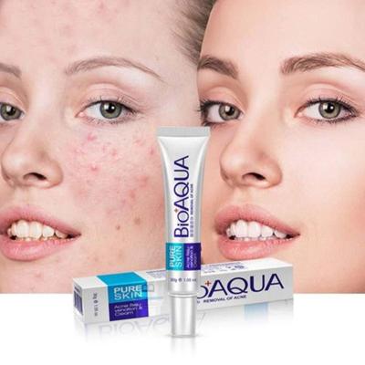 Bioaqua 30 г средство для лечения акне, удаление угрей, крем против прыщей, контроль масла, сужение пор, удаление шрамов от прыщей, уход за лицом, отбеливание