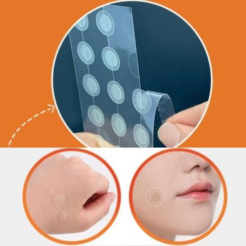 CARE ZONE Cover & Cure Anti-blemish Patches 60ea*2Set