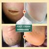 Foot Cream, Heel Cracks To Remove Dead Skin, Skin Care Dry Mask Exfoliation, Gentle and Non-irritating Skin