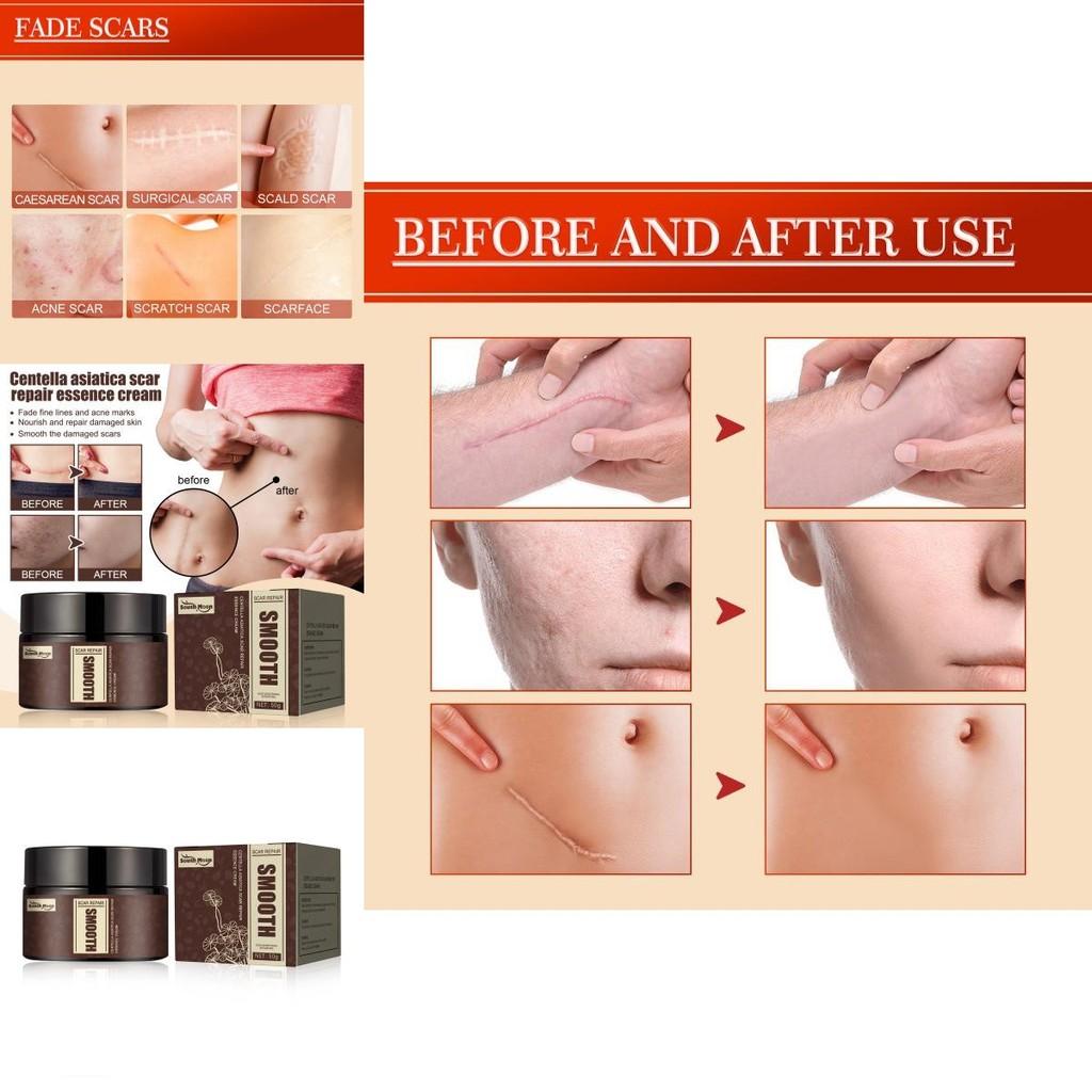 Крем для восстановления рубцов South Moon Centella Увлажняющая формула для подтягивания и разглаживания кожи для рубцов и пятен