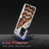 Singer K-Katy Perry Phone Case For Redmi Note 14 15 Pro 5G 13 12 Pro Plus 11 11T 11E 11S 10 Pro 10S 9 9S Cover Cell Clear TPU Ca
