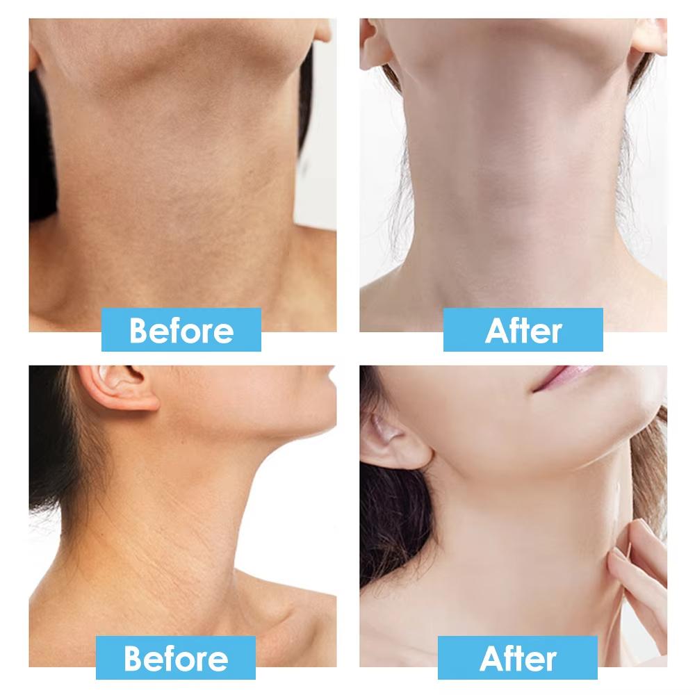 Маска-пленка для шеи с коллагеном из козьего молока для укрепления и омоложения кожи