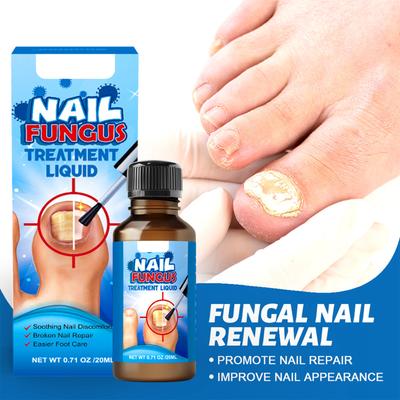 Новая яркая жидкость для ухода за калием. Жидкость для ухода за онихомикозом. Новая яркая жидкость для ухода за ногтями. Онихомикоз улучшает внешний вид ногтей. 20 мл