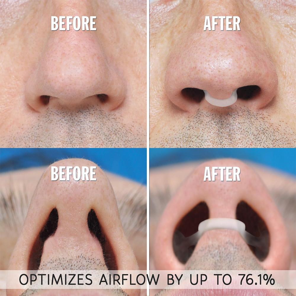 1~4 шт. Силиконовая клипса для носа против храпа, назальный дилататор, средство от храпа, легкое дыхание, улучшение сна, ринит