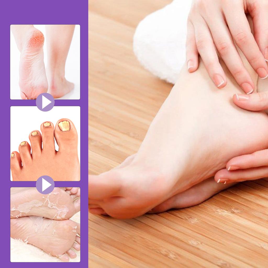EELHOE Ginger Foot Mask Moisturizing Whitening Exfoliating Foot Mask Callus Remover for Feet Pedicure Spa Socks Natural Plant Skin Care