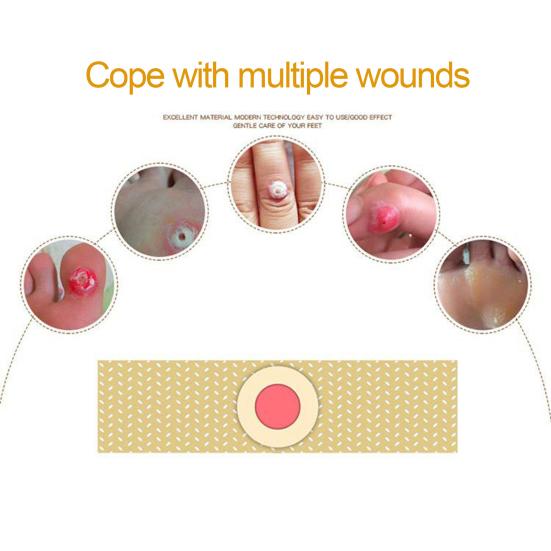 42 шт., безболезненный медицинский пластырь от мозолей, удаление мозолей, смягчение раздраженной кожи, уход за ногами