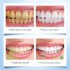 Fruit Series Whitening Toothpaste To Remove Yellow Solid Toothpaste To Remove Tartar And Freshen Breath