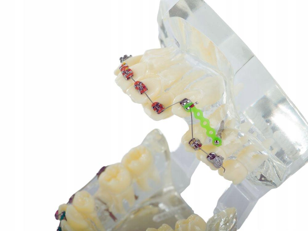 Dental Model Apparatus (100) / 60