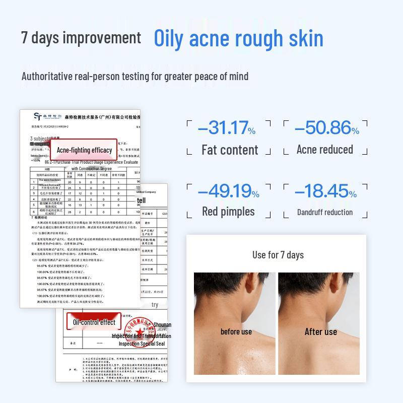 Sakose Teen Sulfur Oil Control Acne Body Wash 500ml