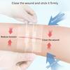 2Pcs/Box Zipper Tie Wound Closure Patch Elastic Strap Fast Suture Hemostatic Patch Skin Care Disinfect Band-Aid Outdoor Portable