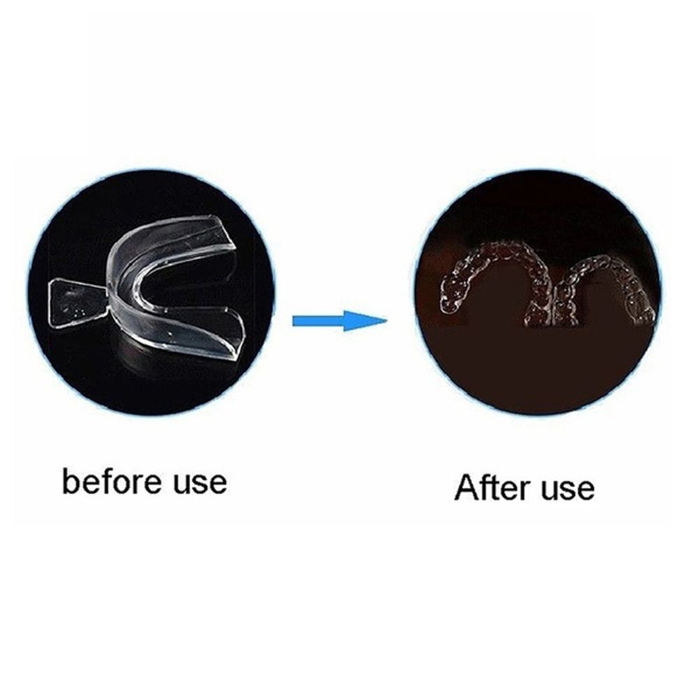 Защита для зубов, сжимающие зубы, покрывает зубы, стоп храпа, капа, защита от укуса, защита для зубов