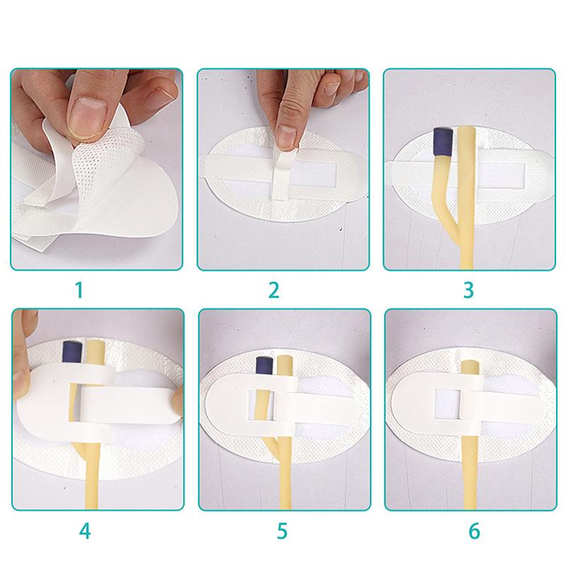 Надлобковый дренажный катетер Катетер для отвода мочи на ногу Двойная трубка Фиксированный ленточный катетер Мочевой катетер Держатели для повязок на ногу Трубка-держатель катетера