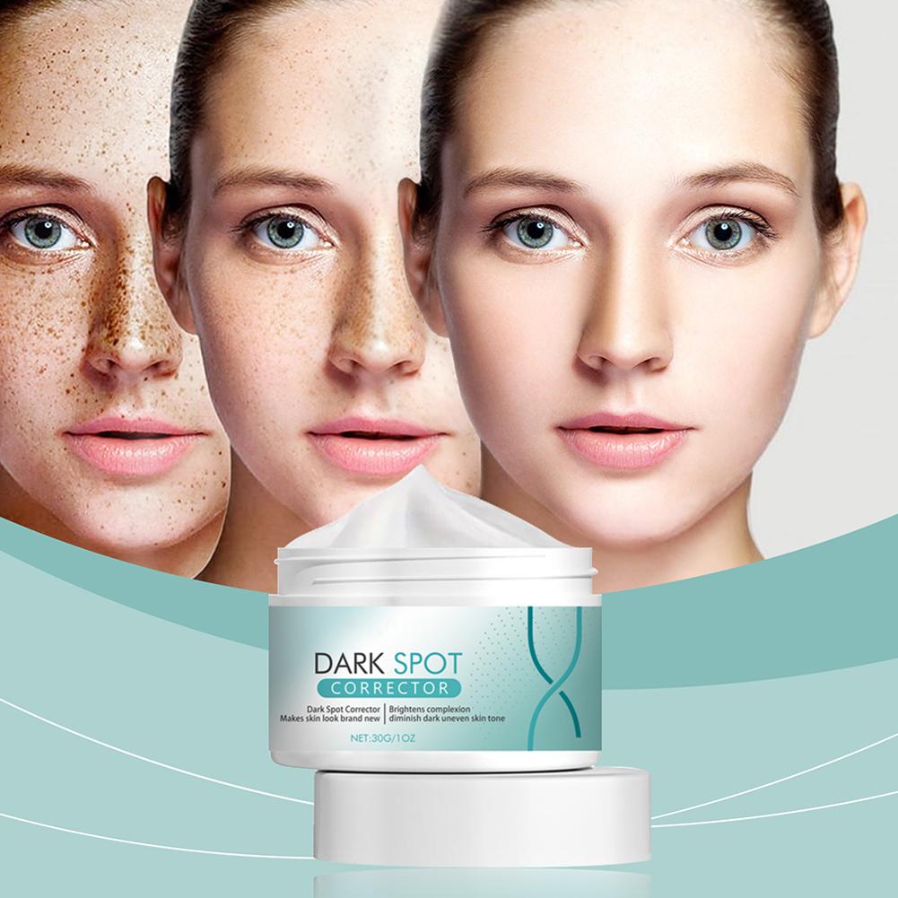 Ретинол Отбеливающий крем от веснушек Осветление тона кожи Осветление Увлажнение Гиалуроновая кислота F I0X3