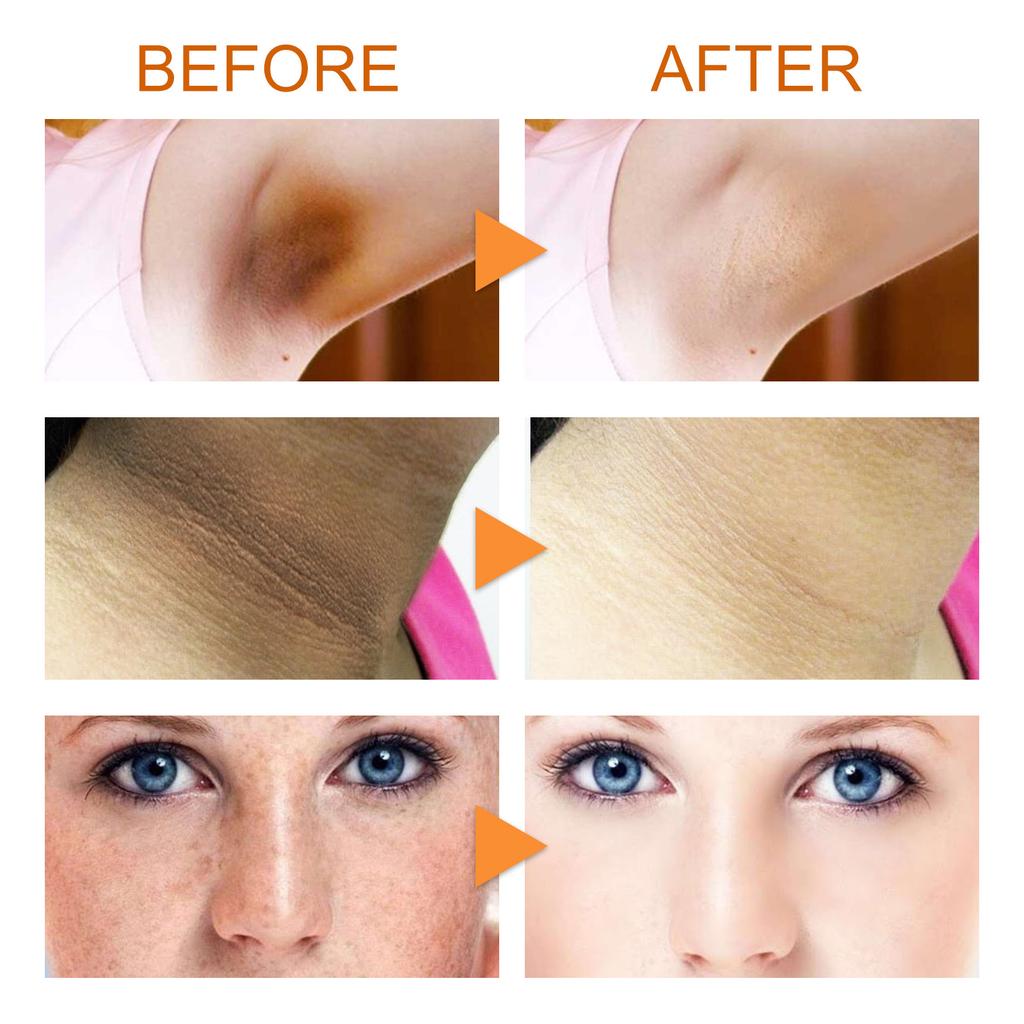 EELHOE Чистящее мыло с витамином С. Глубоко очищающее мыло. Мыло для ванны. Отбеливающее мыло. Увлажняющее чистящее средство. Избавьтесь от черных точек.