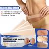 4 шт. Пластырь для восстановления кожи Водонепроницаемый Эффективный Самоклеящийся Долговечный Легкий Осветляет Пигментацию Не раздражающий Силиконовый Уход за рубцами для Семьи