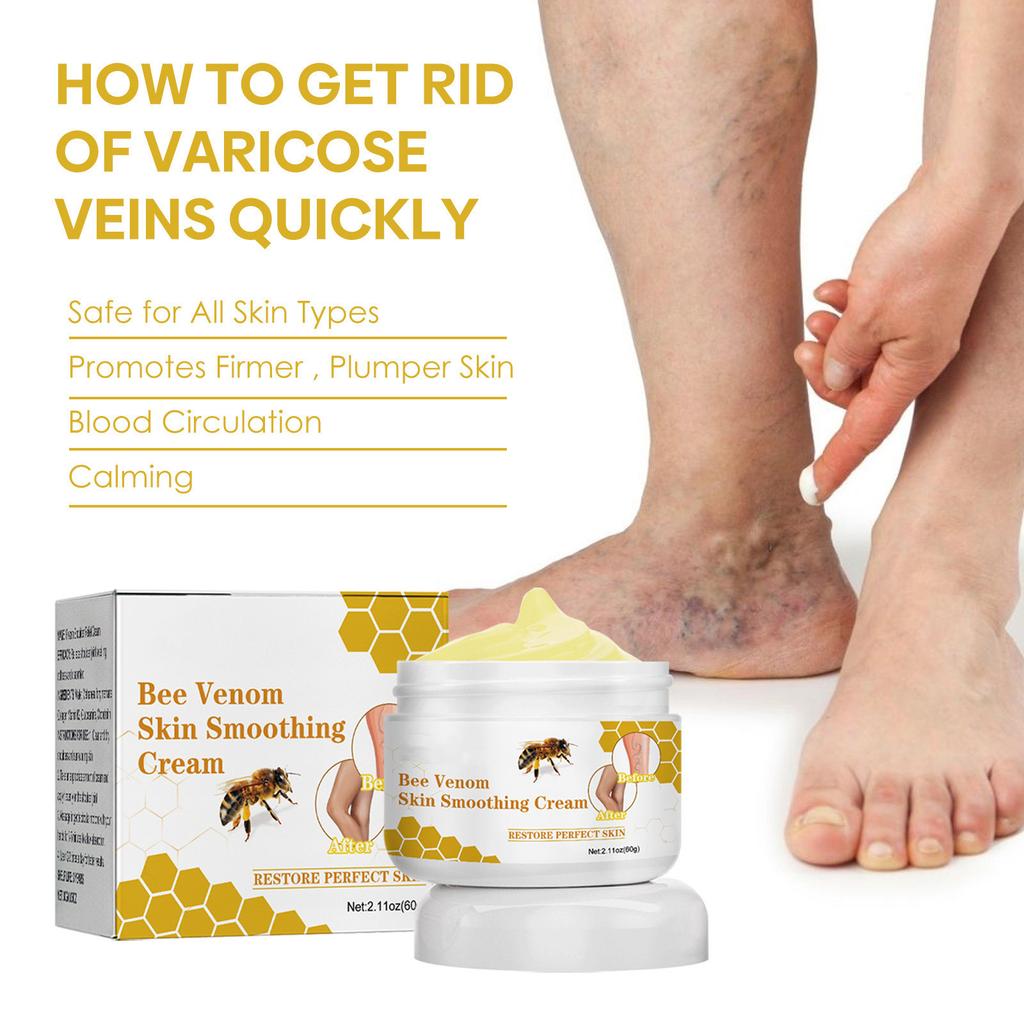 Venoheal Varicose Vein Ease Paste, Varicose Veins Paste, Varicose And Spider Veins Ease For Legs, Improve Blood Circulatio