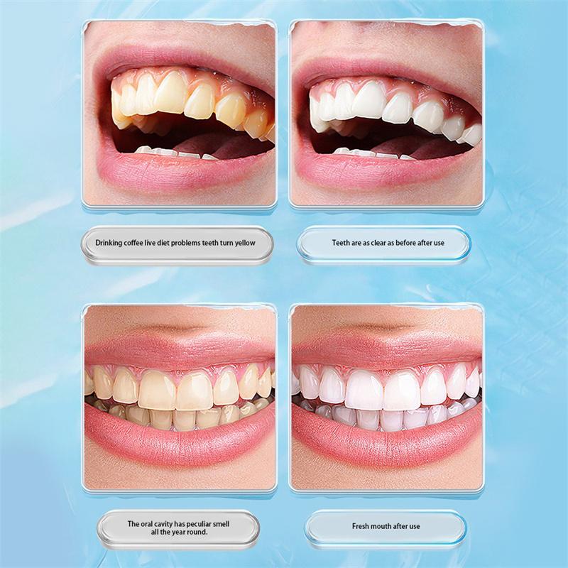 GECOMO Щетка для чистки пятен на зубах Глубоко очищает десны во рту, не повреждает зубы, удаляет зубной камень Портативный стоматологический очиститель