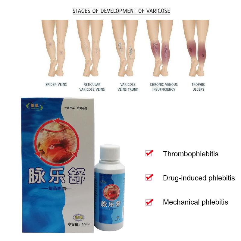 Foot Leg Veins Plaster Leg Spray Spray Swelling Healthy Professional Spray